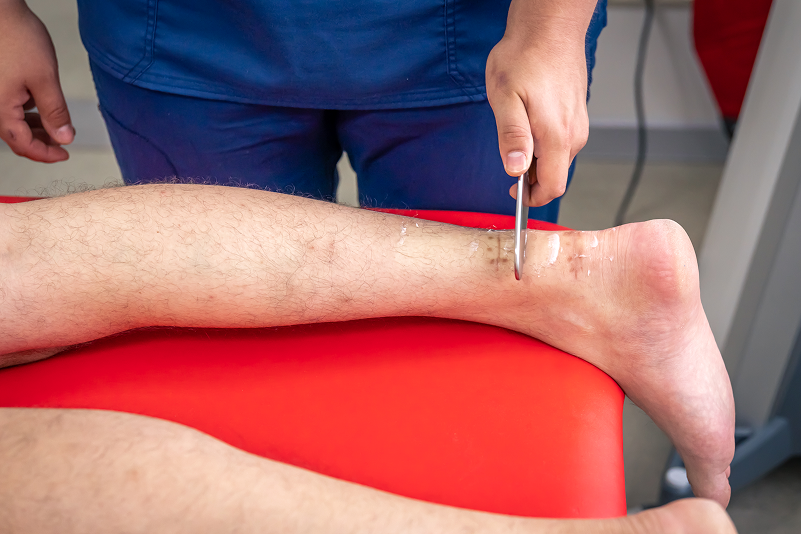 Peripheral Arterial Disease (PAD)